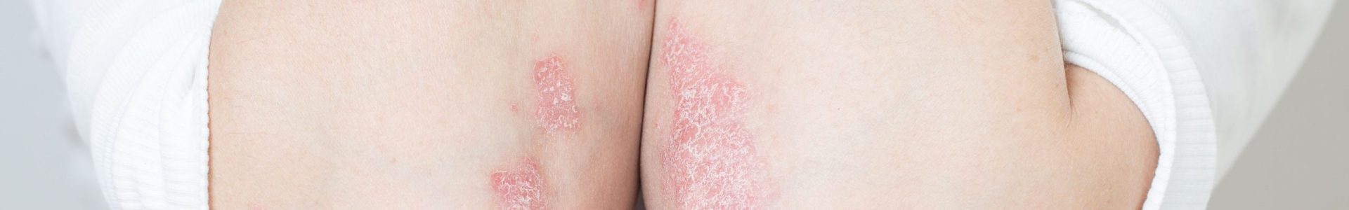 website banner (1920 x 300 px) (13)